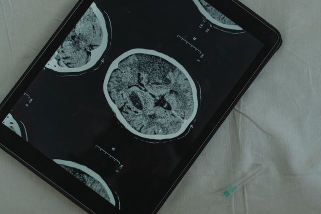 Brain injury lawyer in Bakersfield reviewing a traumatic brain injury scan with an injured client
